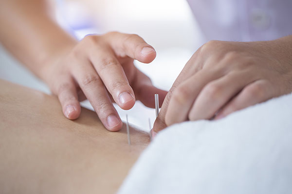 一般鍼灸ベーシックコースイメージ画像