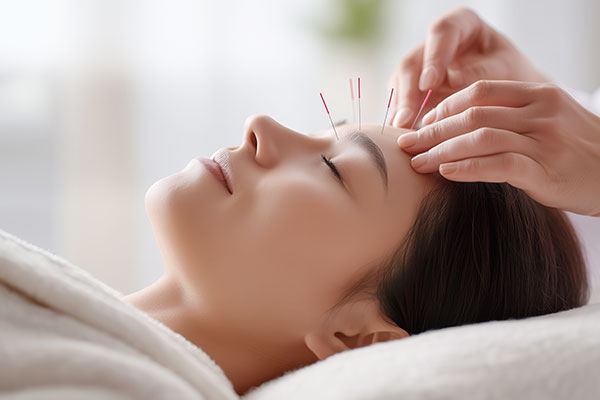 鍼灸治療のイメージ画像